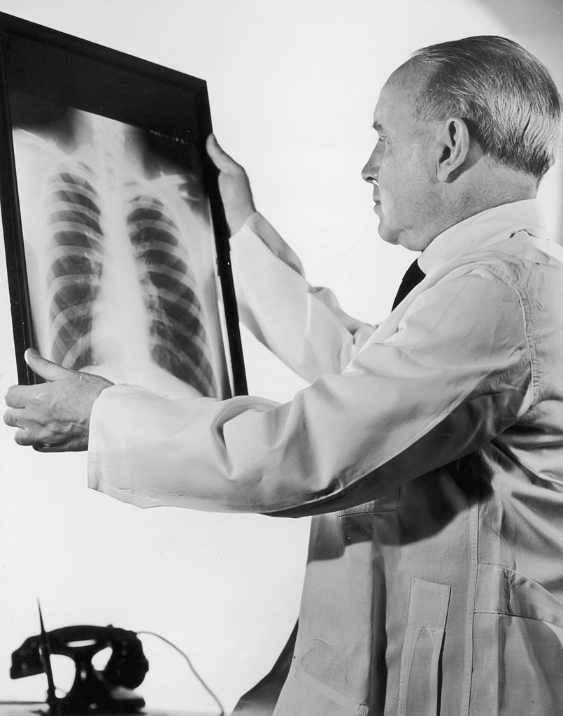 x-ray letter x